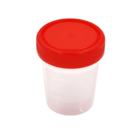 Pratik Plastik Numune Kabı İdrar Kabı 60 ML Pratik Plastik Numune Kabı İdrar Kabı 60 ML